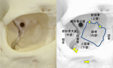 皮膚を切らない眼窩骨折の手術 群馬県前橋市の眼科形成外科 かしま眼科形成外科クリニック 眼科 眼形成眼窩外科 形成外科