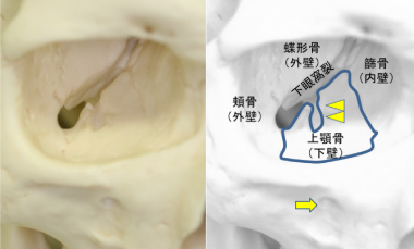 皮膚を切らない眼窩骨折の手術 群馬県前橋市の眼科形成外科 かしま眼科形成外科クリニック 眼科 眼形成眼窩外科 形成外科